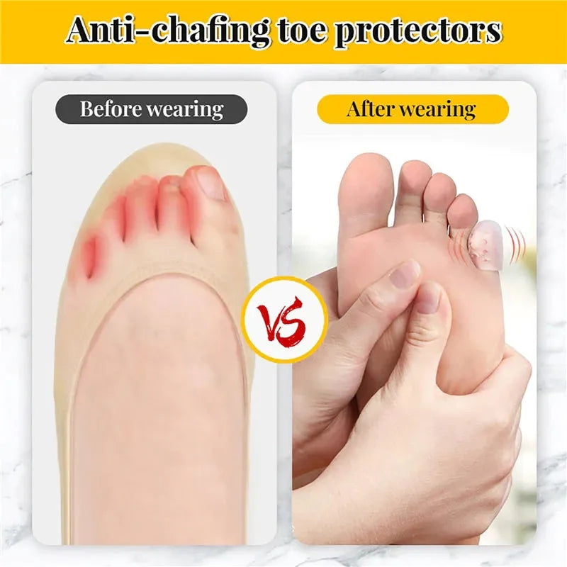 Silicone Anti-Friction Toe Protector