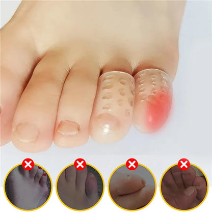 Silicone Anti-Friction Toe Protector